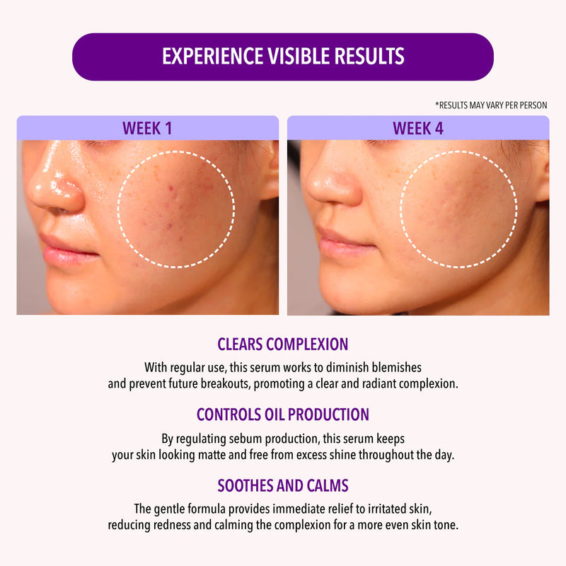 10% Niacinamide & 1.9% Salicylic Acid Oil Control